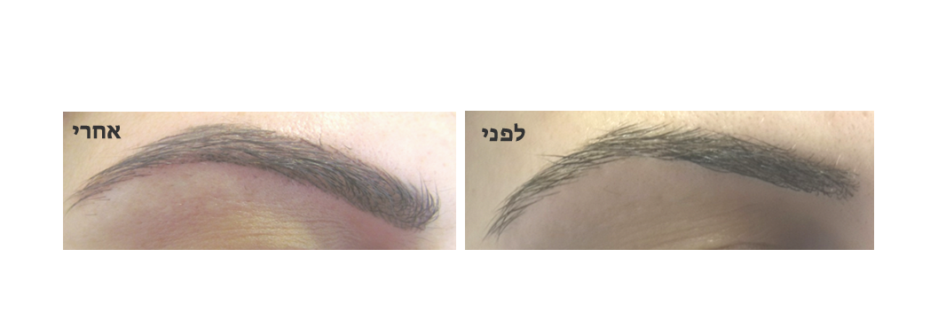 איפור קבוע - גבות בשיטת השערה 5