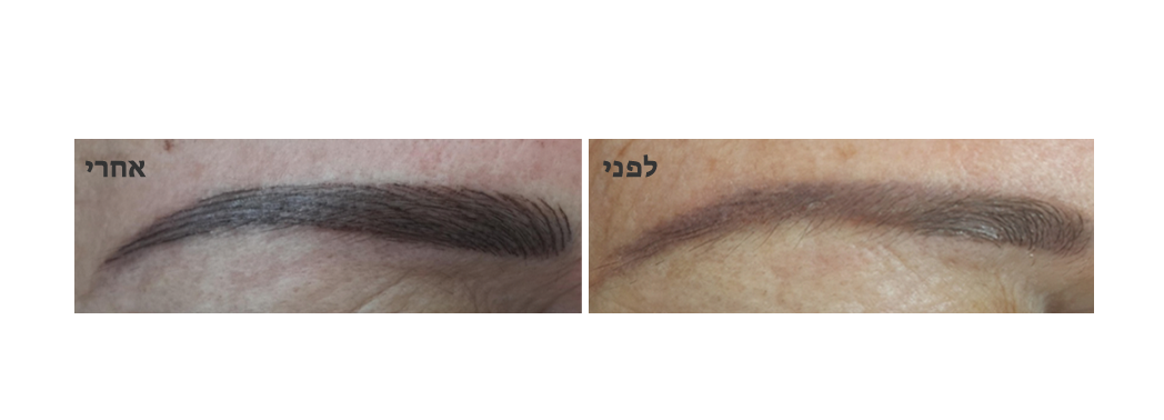 איפור קבוע - גבות בשיטת השערה 3