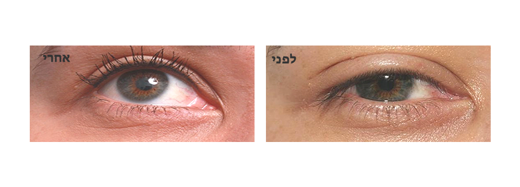 עיצוב קו עין איילינר 3